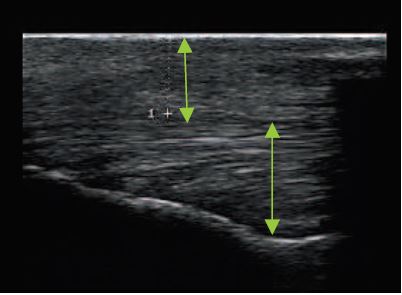Echographie face interne du genou gauche cheval
