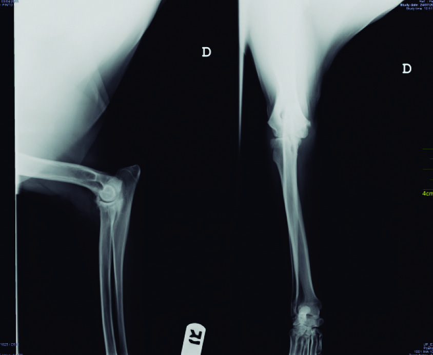 Traitement de la douleur liée à l’arthrose canine avec la thérapie par radiofréquence à 448 KHz : comparaison de 5 cas cliniques