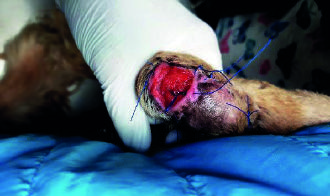 Application de la radiofréquence monopolaire résistive et capacitive à 448 KHz dans la cicatrisation d’une plaie cutanée après exérèse d’un sarcome des tissus mous