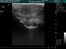 radiographie enthesopathie ligament cheval