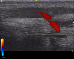 radiographie jarret therapie laser cheval