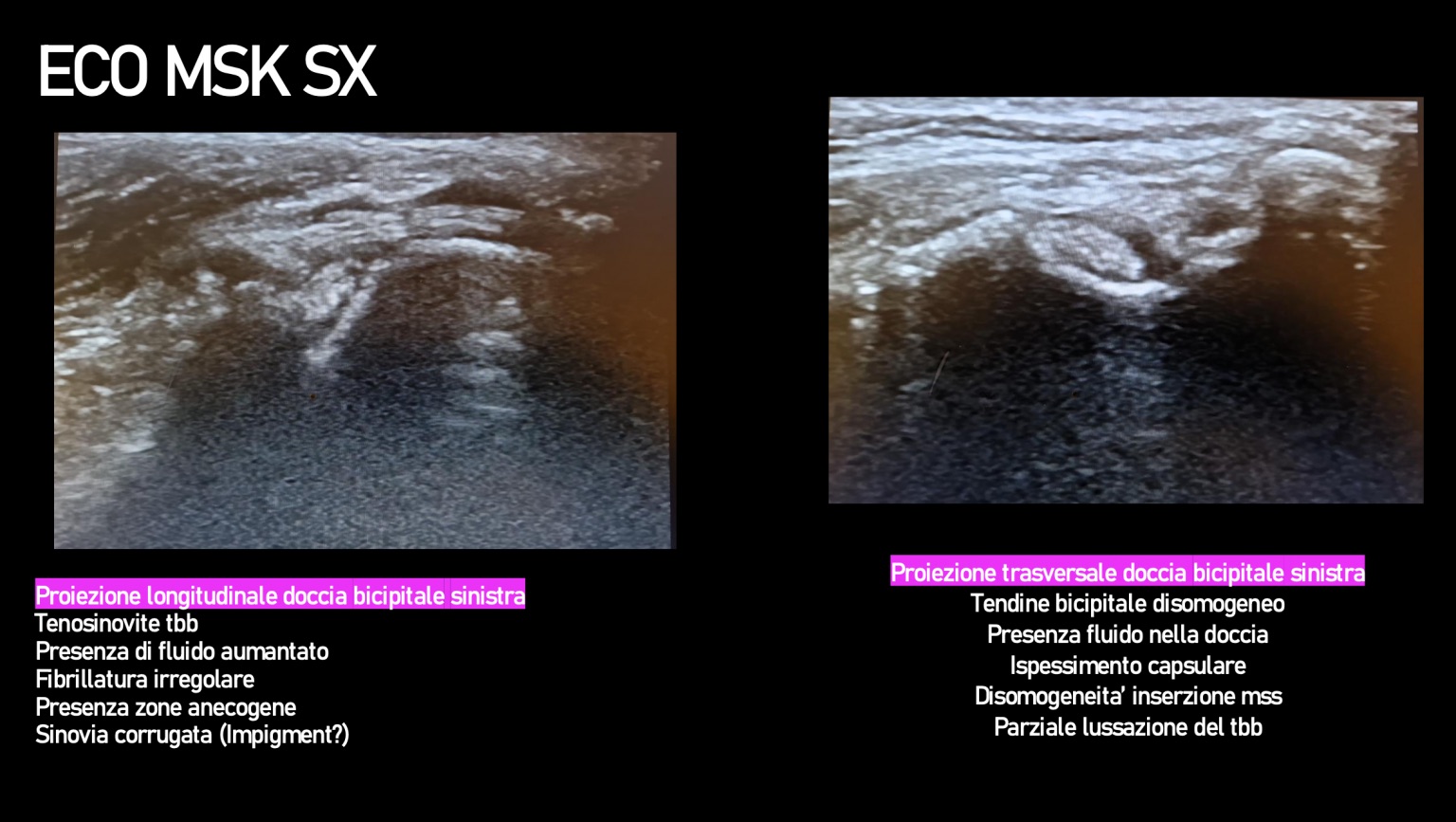 Cas clinique tendinopathie echographie resultats