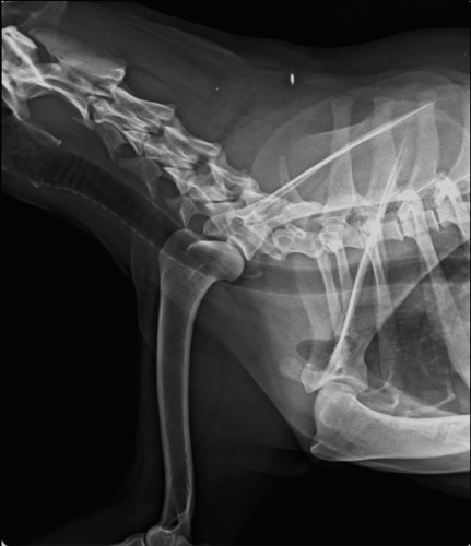 Cas clinique tendinopathie radio