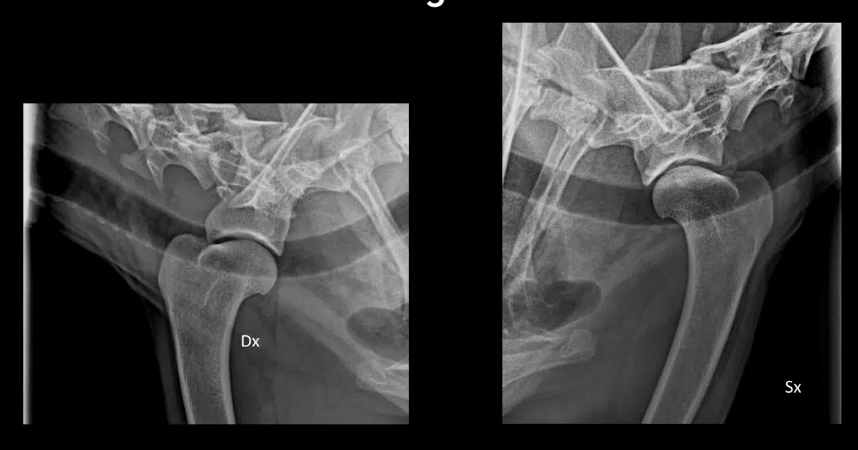 Cas clinique tendinopathie radio