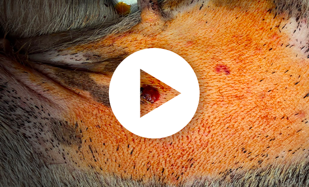 Chirurgie exérèse masse abdominale